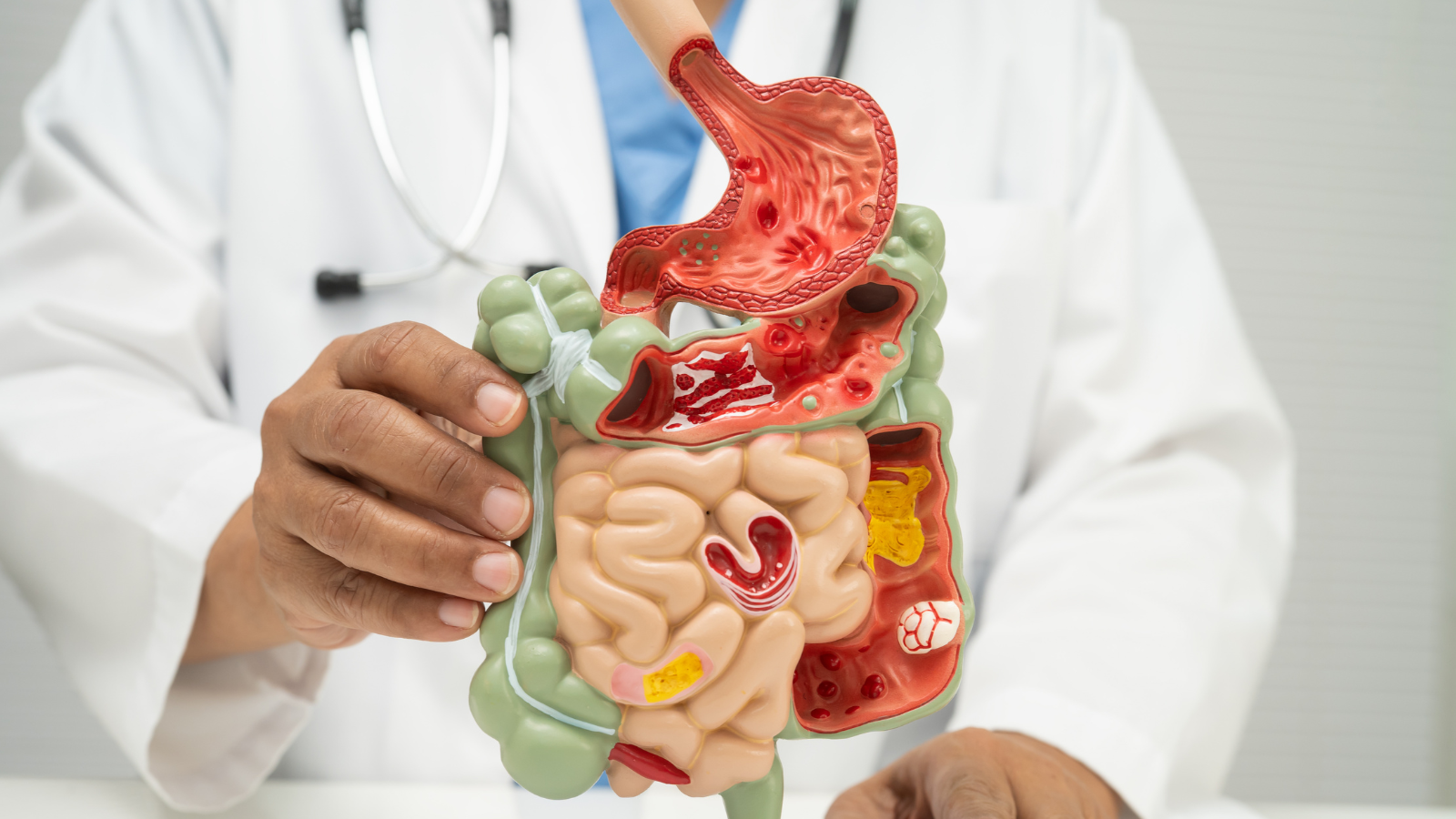 Có vấn đề về dạ dày và đường ruột