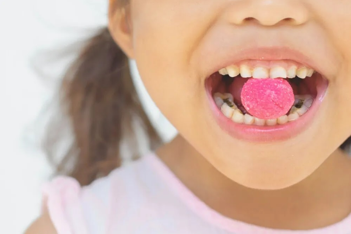 Ăn bánh kẹo ngọt là một trong những thủ phạm gây sâu răng nhiều ở trẻ