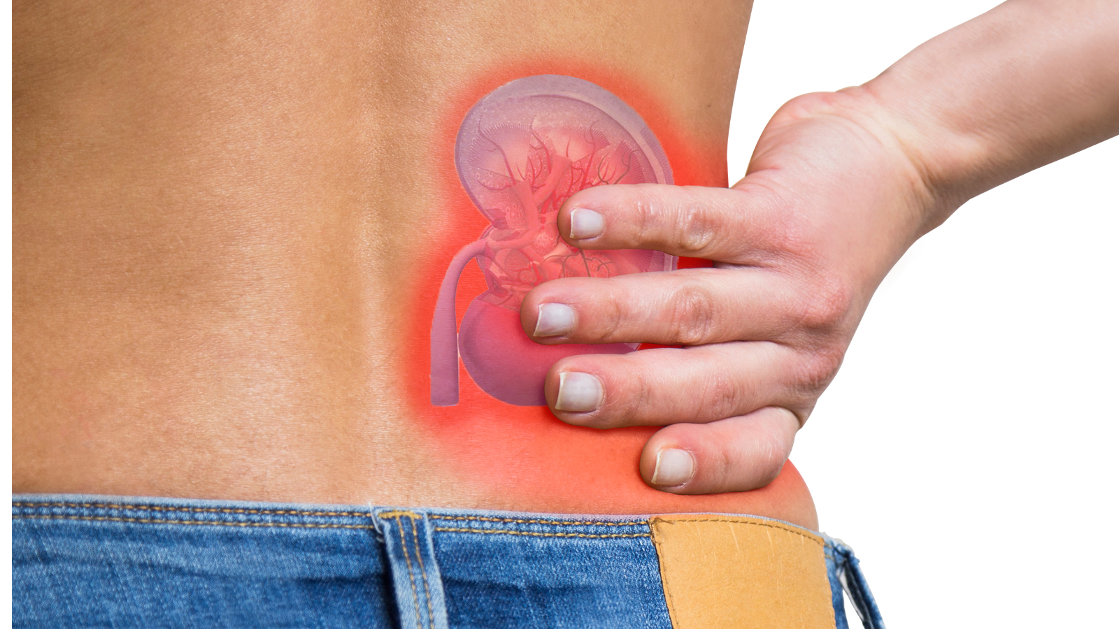 Triệu chứng ung thư thận giai đoạn cuối là gì? Cách nhận biết sớm nhất 1