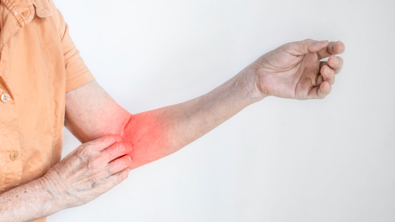 Cái ghẻ (Sarcoptes scabiei) là một trong những tác nhân gây bệnh da liễu