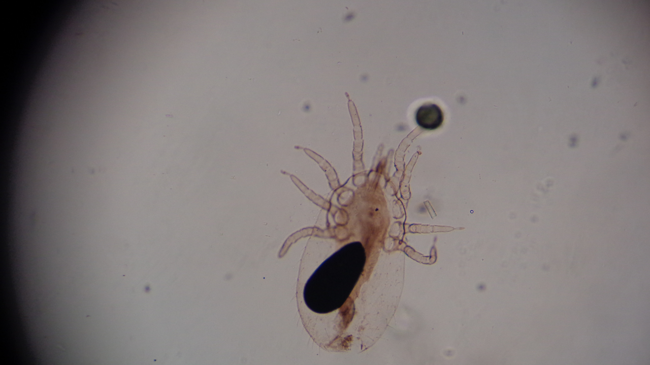 Con cái ghẻ (Sarcoptes scabiei) có kích thước dài khoảng 0,30 - 0,45 mm và rộng 0,25 - 0,35 mm