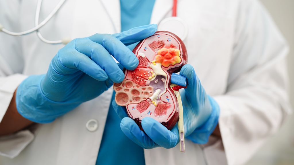 Tìm hiểu về chỉ số creatinin niệu là gì