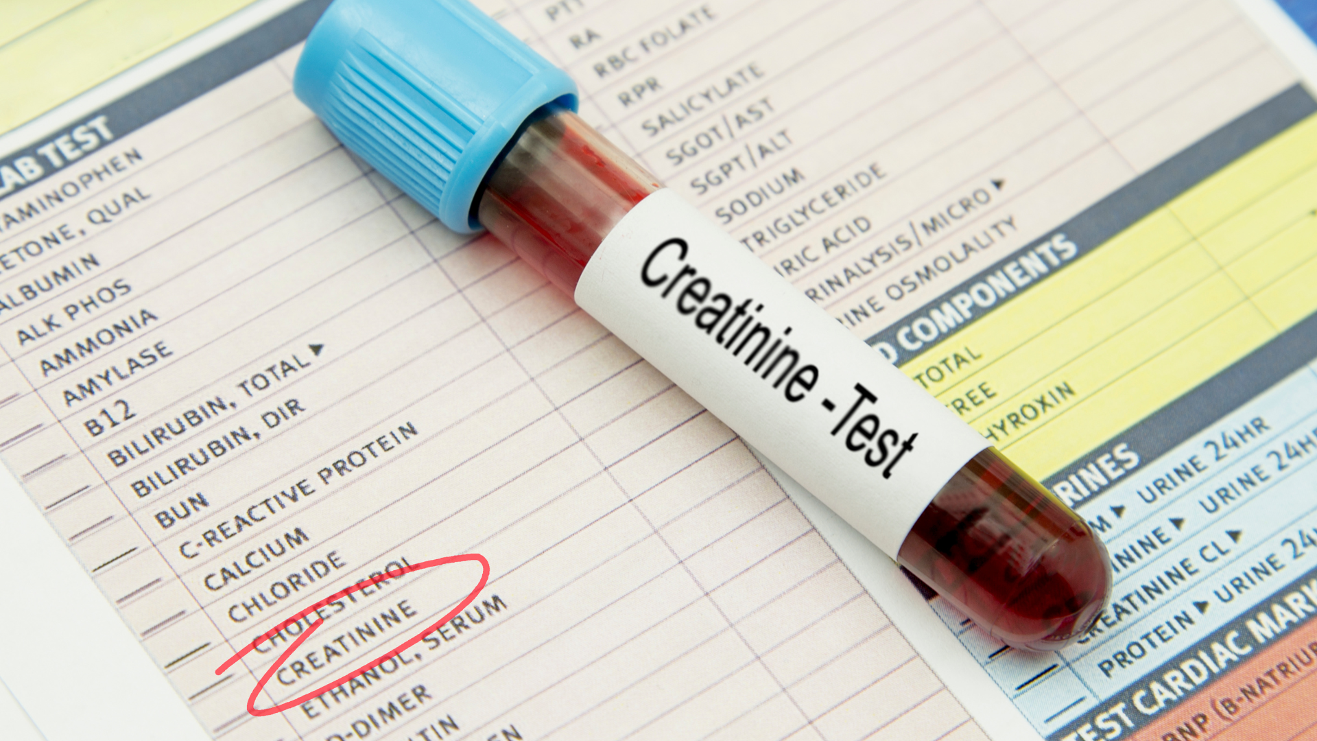 Creatinine cao không phải là một bệnh riêng biệt mà là dấu hiệu cho thấy thận đang lọc máu kém hiệu quả hơn bình thường