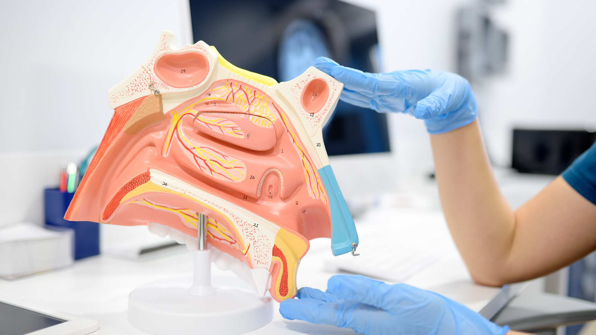 Phì đại cuốn mũi gây khó thở, chóng mặt, ảnh hưởng tới chất lượng cuộc sống