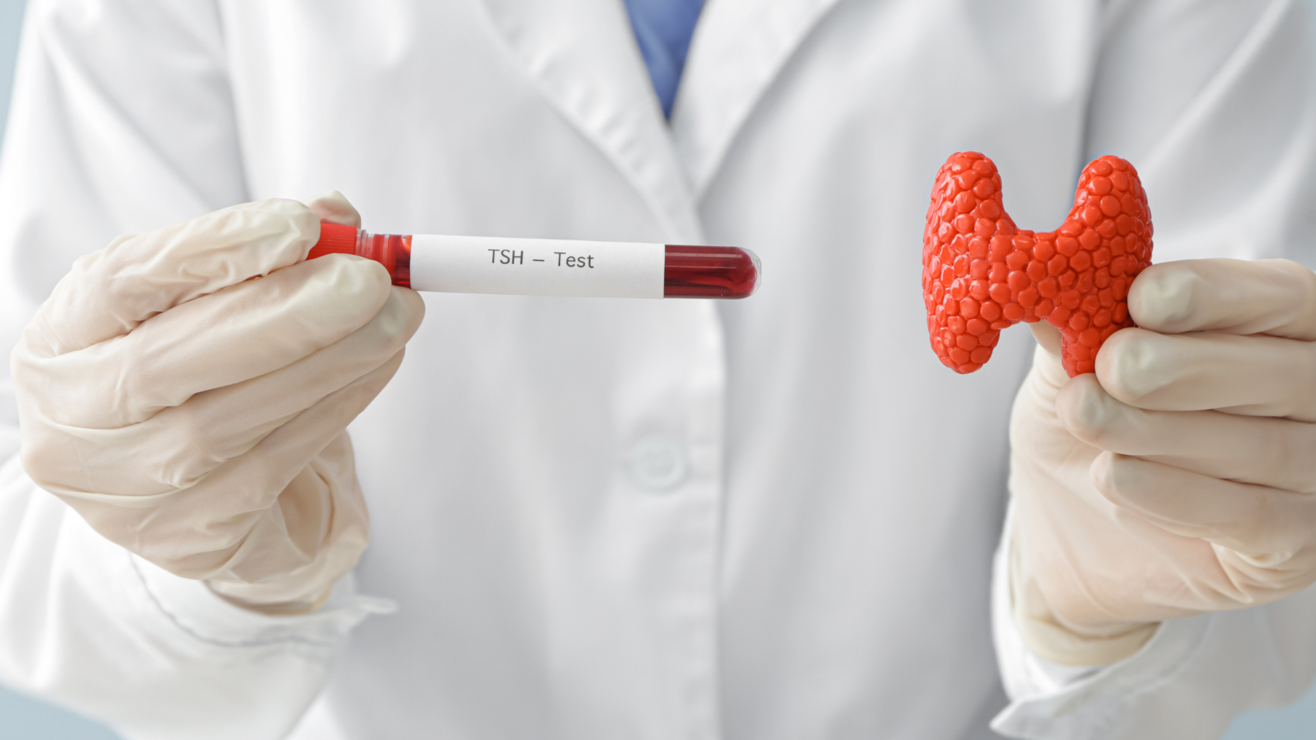 Xét nghiệm TSH giúp phát hiện rối loạn tuyến giáp