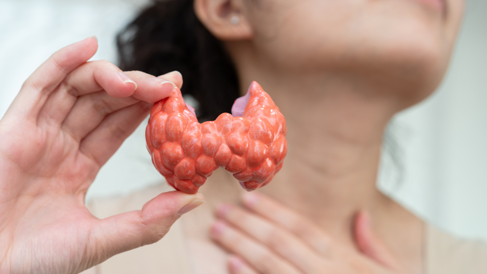 Bệnh Basedow thường gây tăng sinh mạch máu rõ