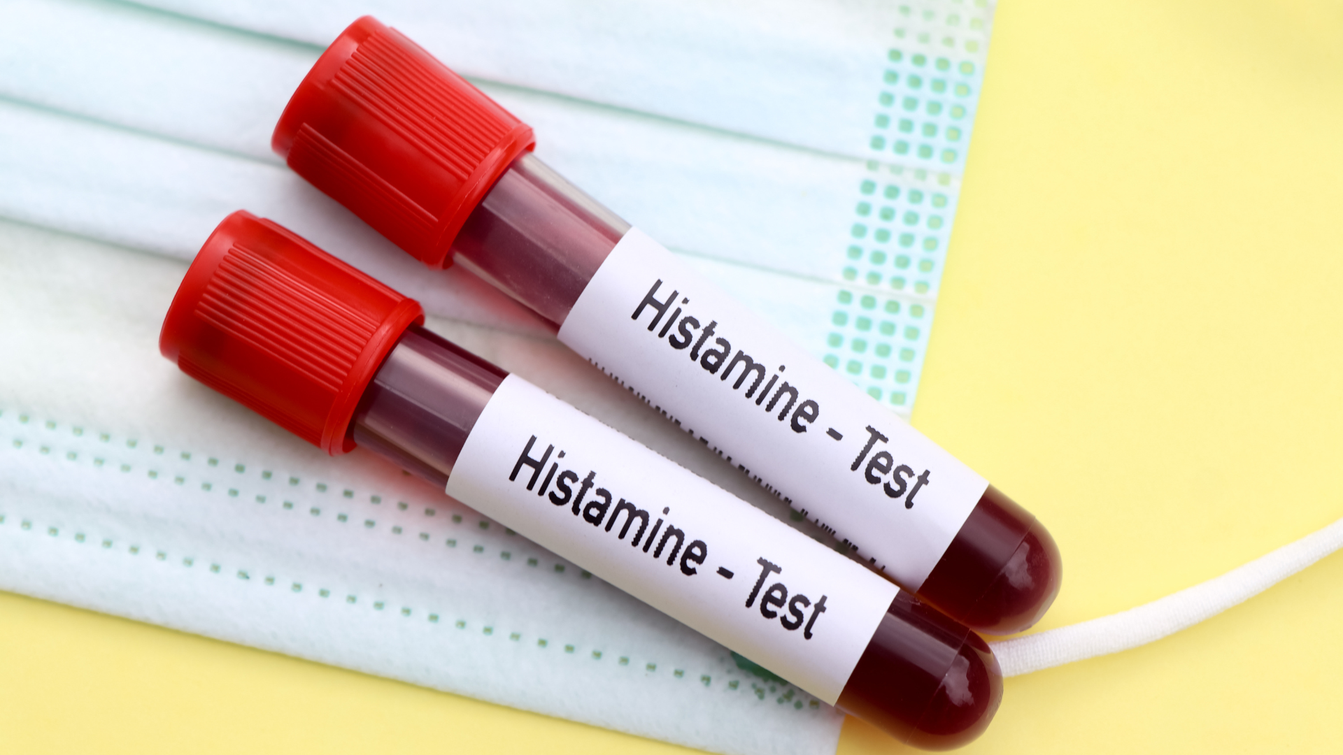 Tăng histamine máu cũng có thể gây ngứa và nổi hột bất thường trên da