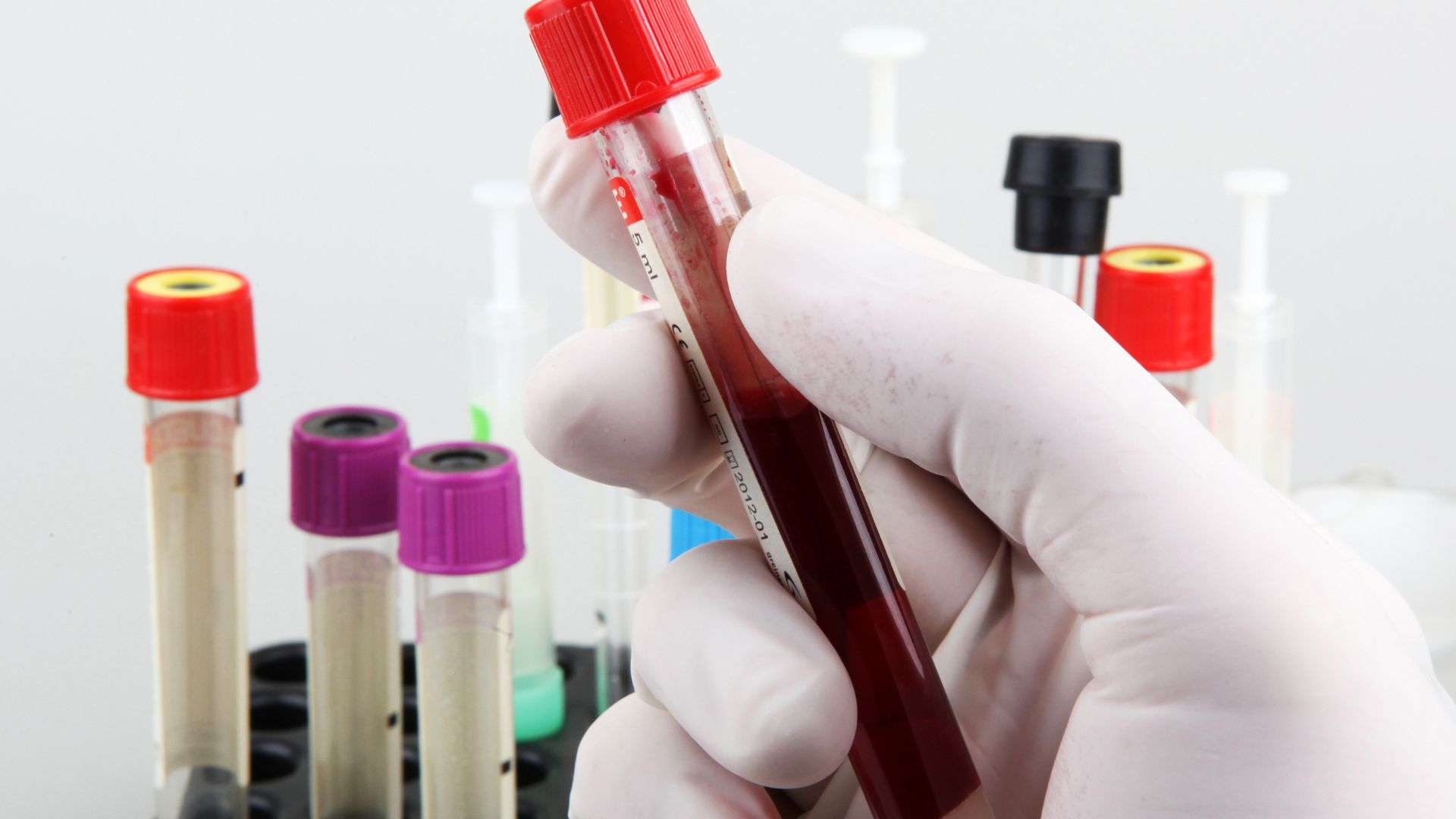 Xét nghiệm máu định kỳ giúp bác sĩ đánh giá được tình trạng sức khoẻ của người bệnh