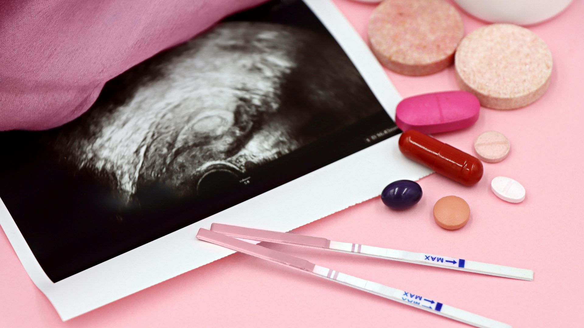 Thuốc ức chế prostaglandin được sử dụng trong điều trị đa ối