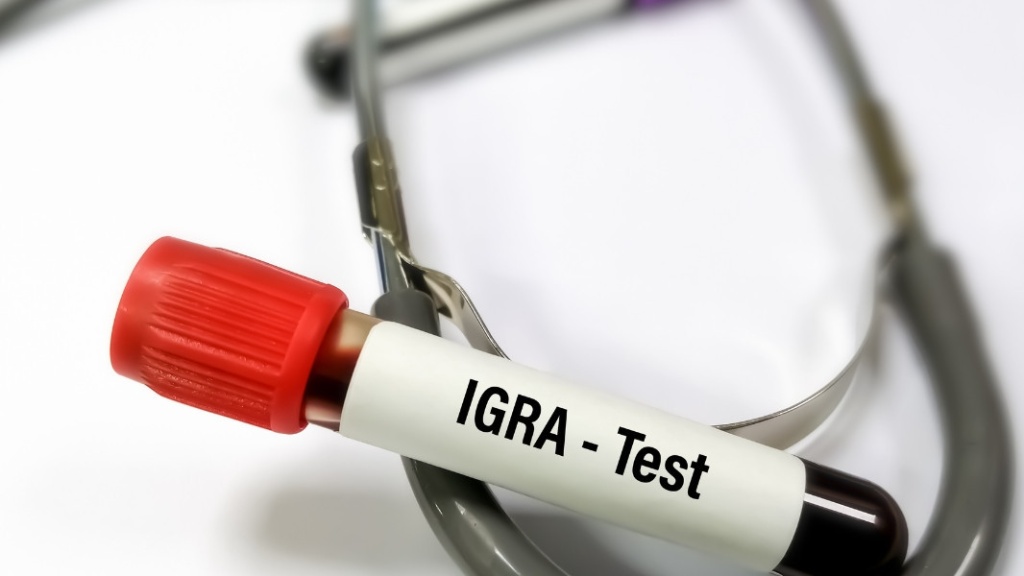 dac-diem-cua-vi-khuan-lao-va-cach-phong-ngua-hieu-qua 1.jpg