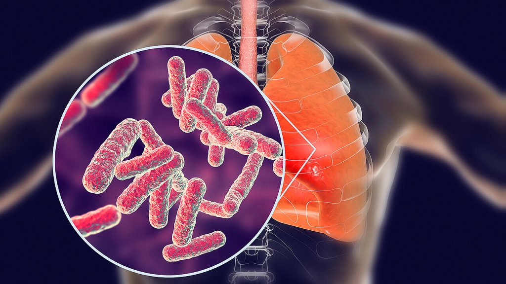 dac-diem-cua-vi-khuan-lao-va-cach-phong-ngua-hieu-qua 4.jpg