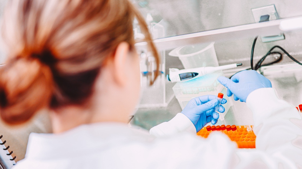 dac-diem-cua-vi-khuan-ta-va-cach-phong-ngua 1.jpg