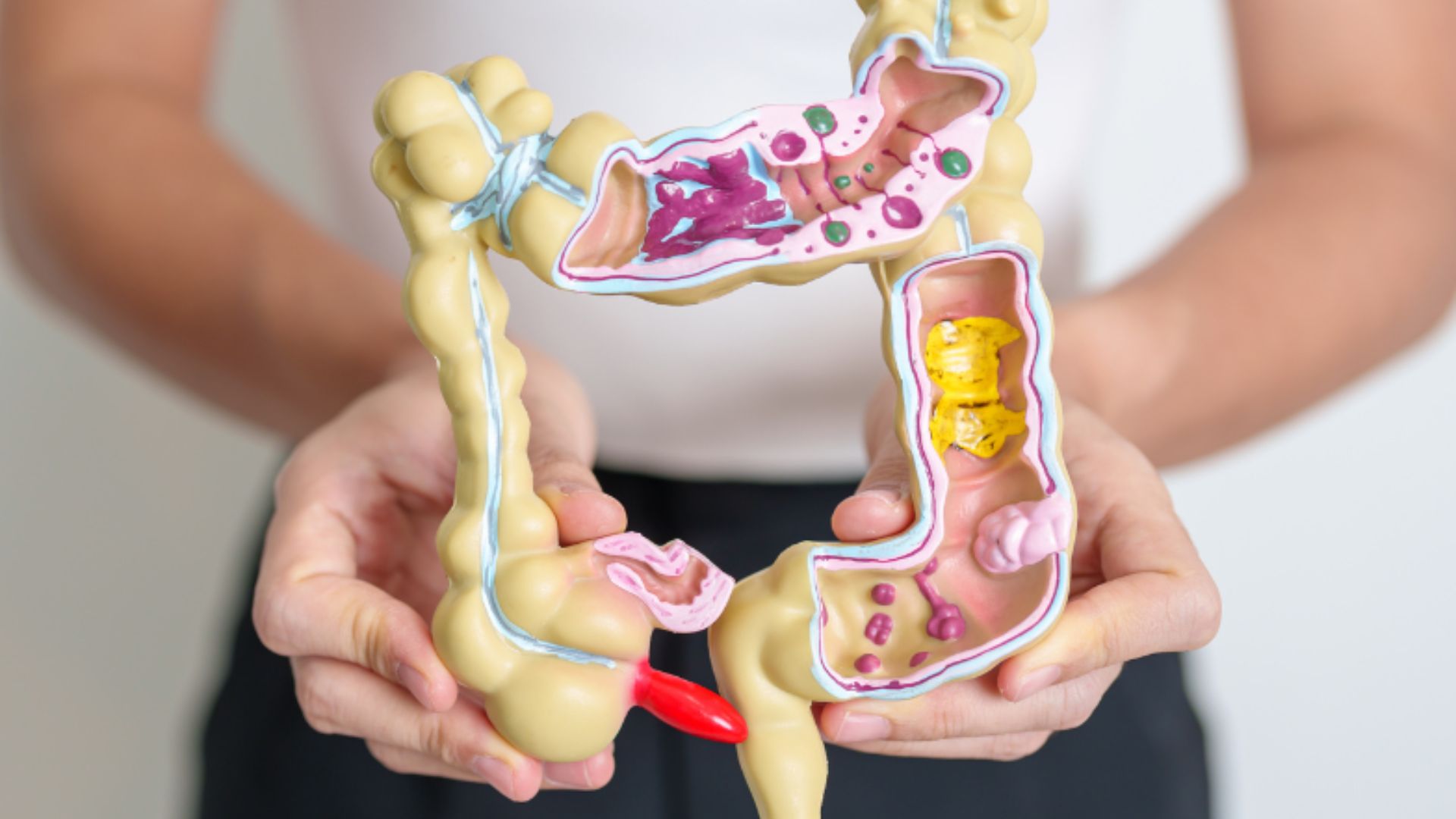 Đại tràng là gì? Vai trò, bệnh lý liên quan và hướng chăm sóc hiệu quả 1