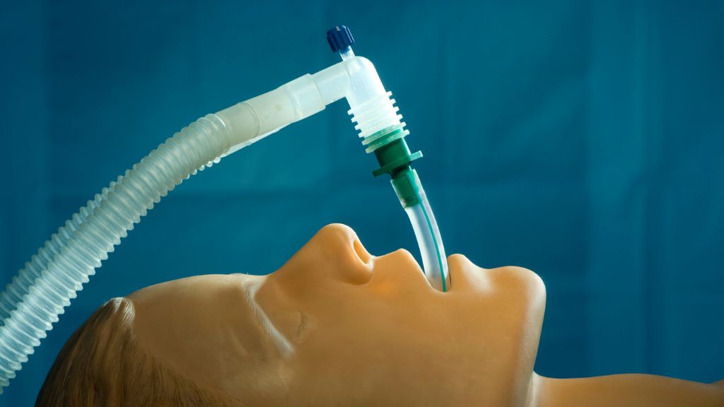 Đặt nội khí quản là gì?