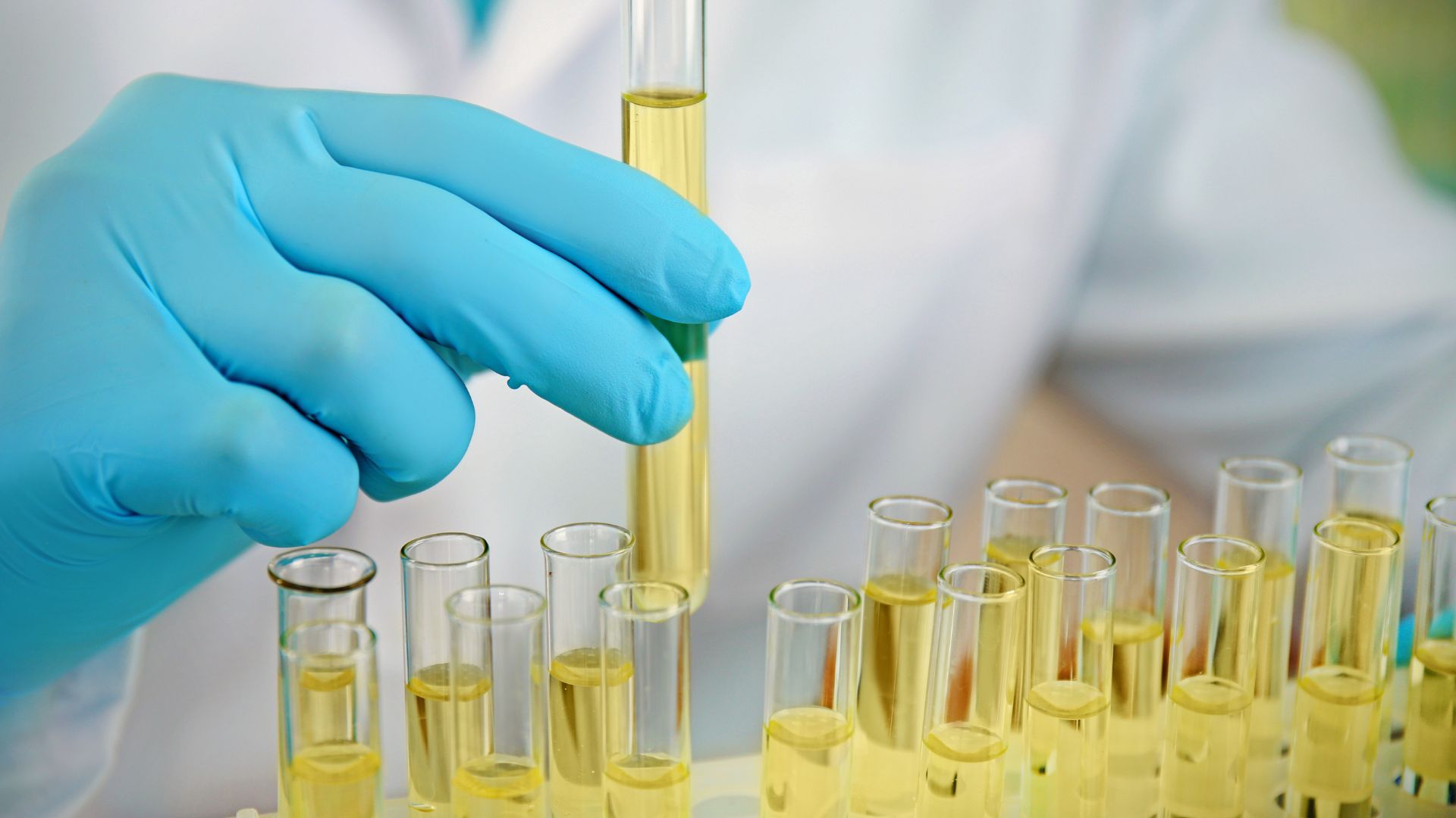 Xét nghiệm nước tiểu giúp chẩn đoán viêm bàng quang và loại trừ tiểu máu do nguyên nhân khác