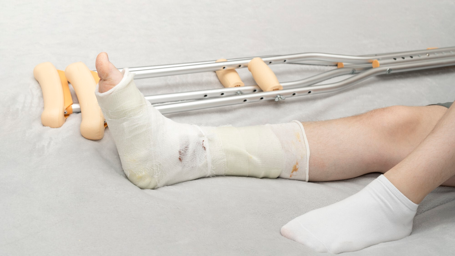 Khi bị đau cổ chân, bạn có thể sử dụng nạng hoặc dụng cụ hỗ trợ đi lại nếu cơn đau nghiêm trọng