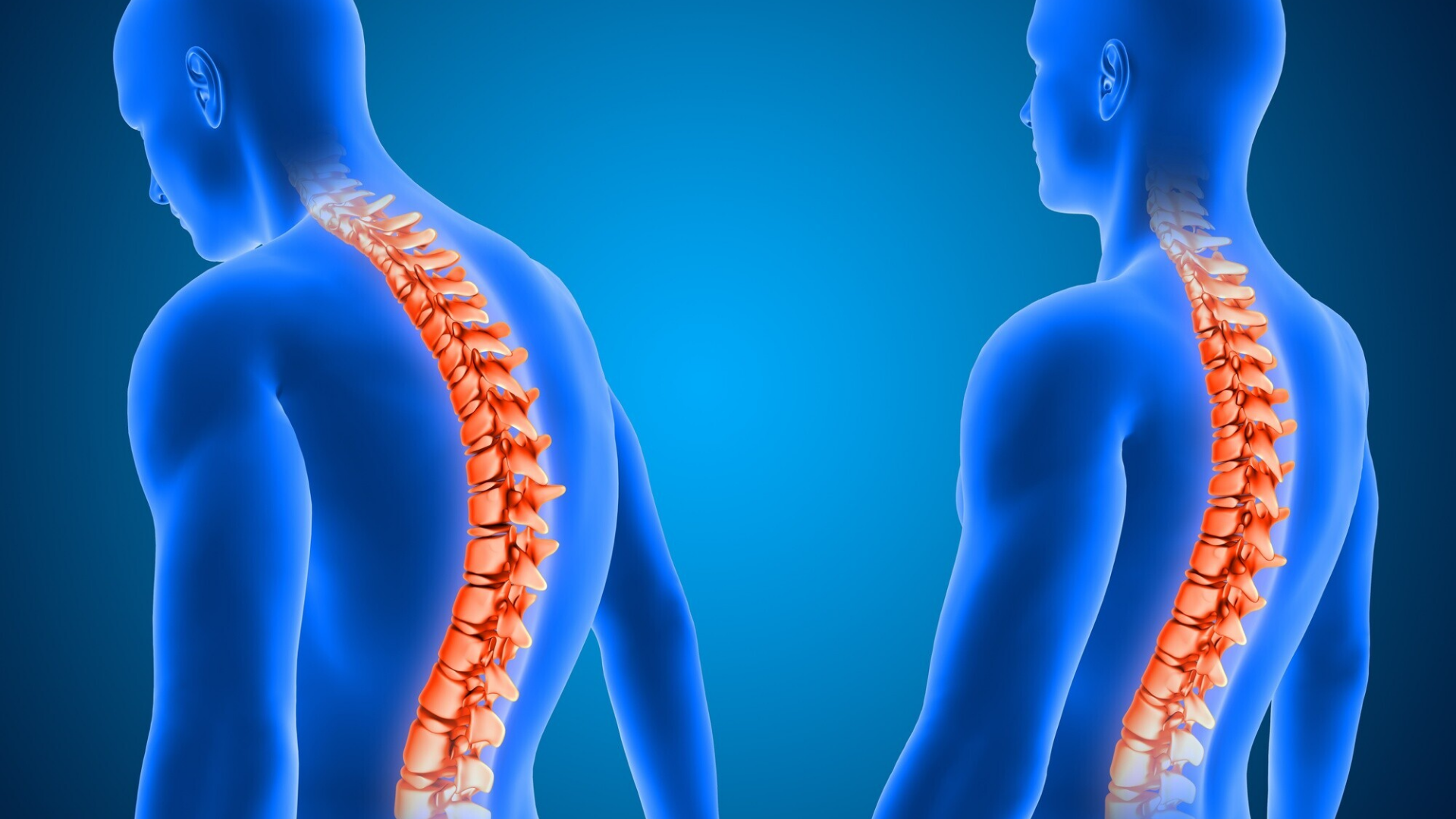 Triệu chứng đau cơ lưng có thể liên quan đến các bệnh lý khác nghiêm trọng