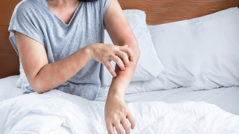 Dấu hiệu dị ứng: Nhận biết sớm và xử lý đúng cách tránh biến chứng 1