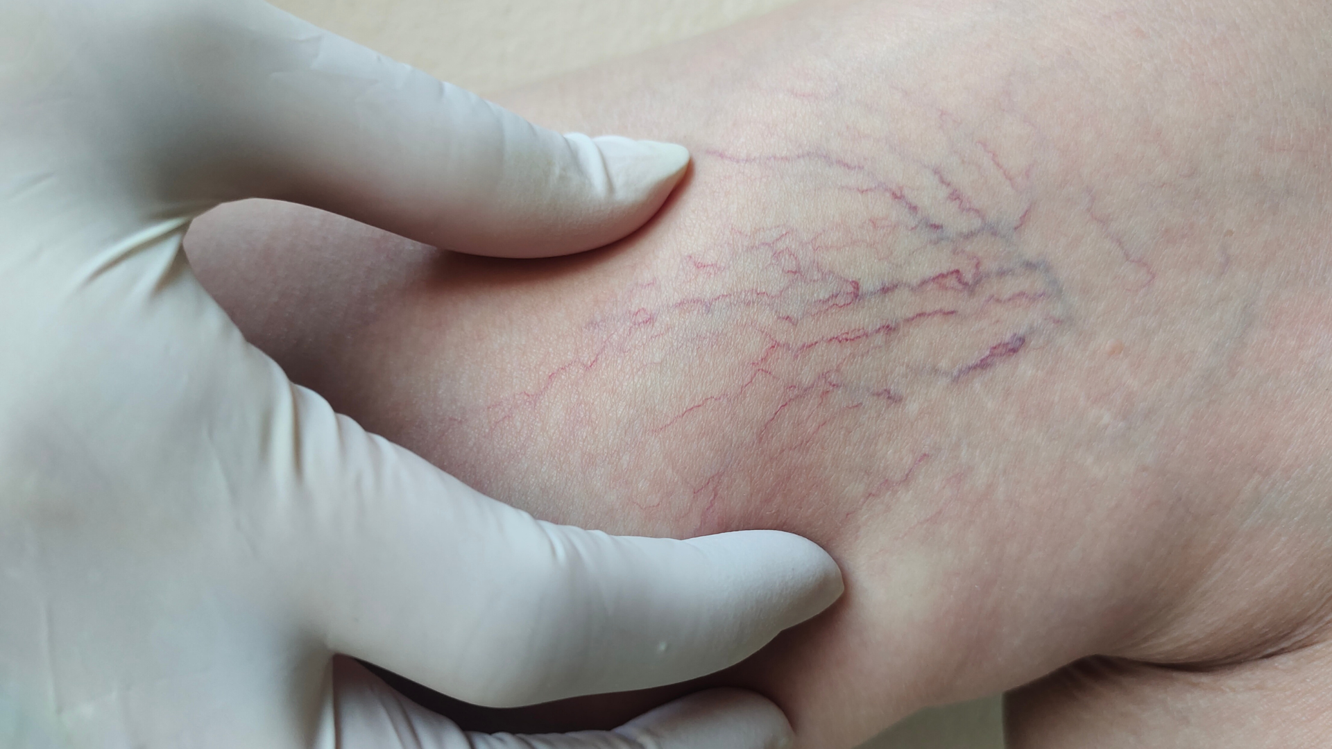 Lộ trình chăm sóc từ thay đổi lối sống đến can thiệp khi cần
