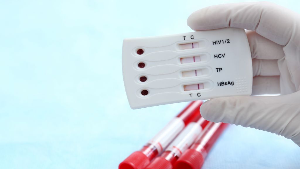 Dấu hiệu HIV và những thông tin liên quan về bệnh cần nắm! 5