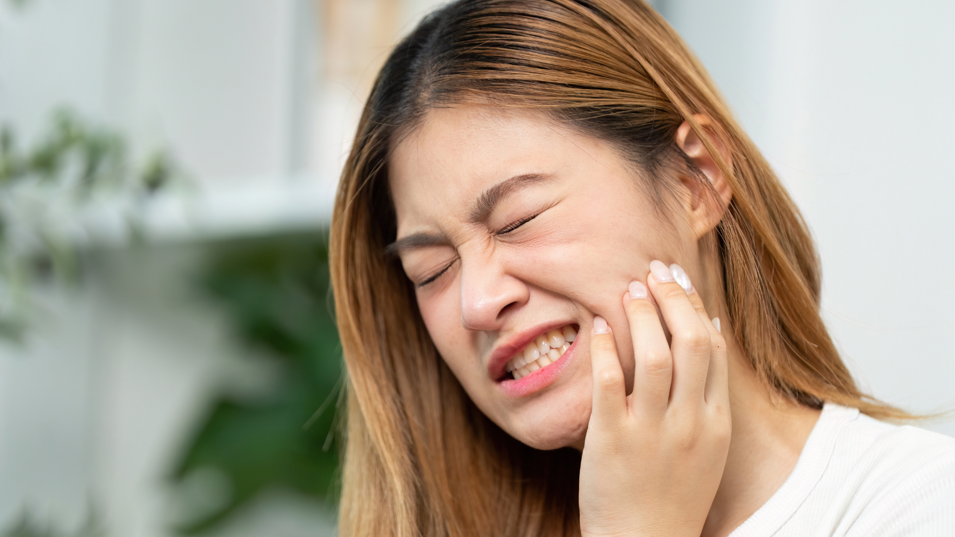 Lý do răng khôn dễ gây biến chứng và tổn thương răng bên cạnh