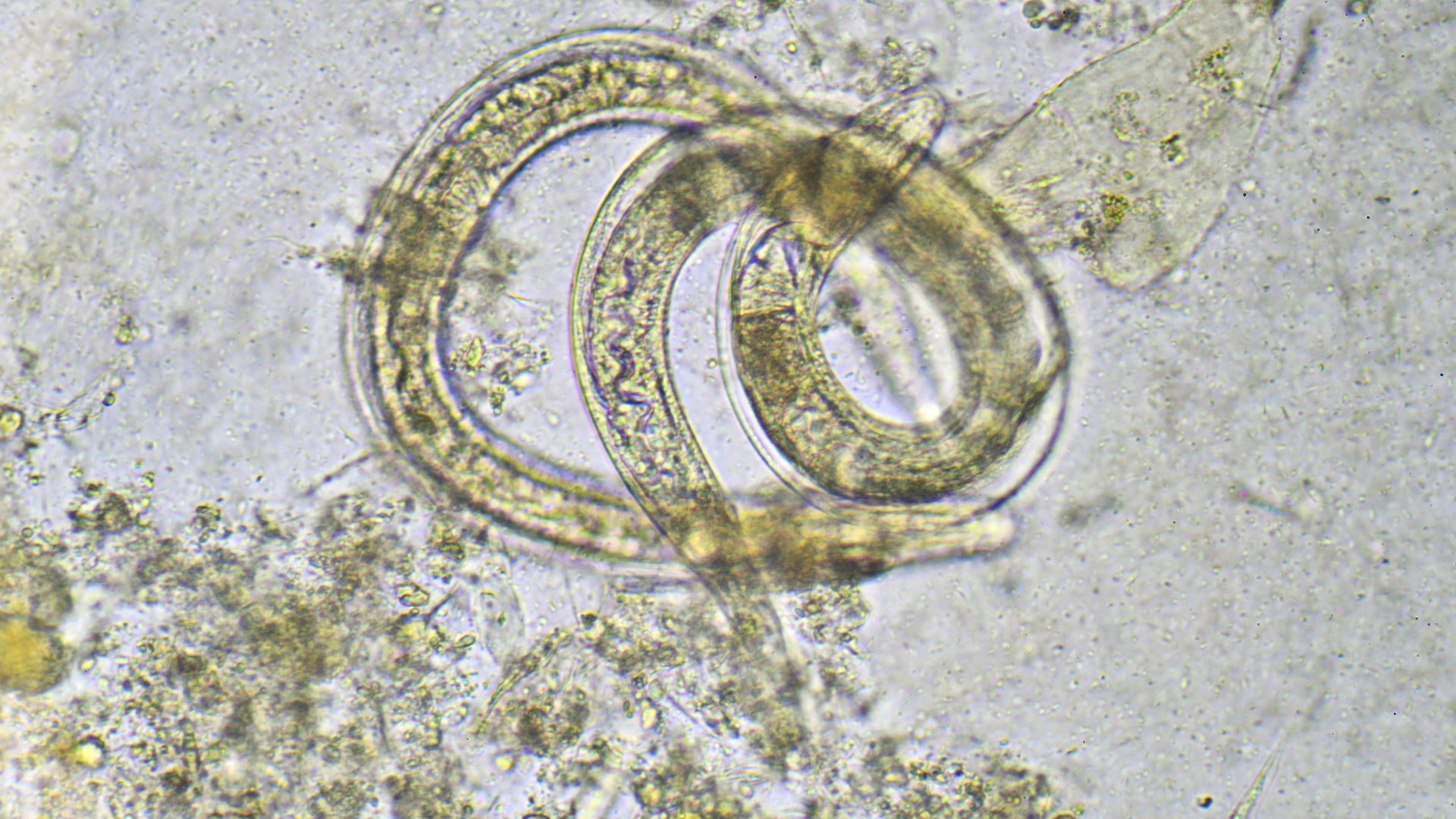 Giun tròn là một loại ký sinh trùng rất phổ biến