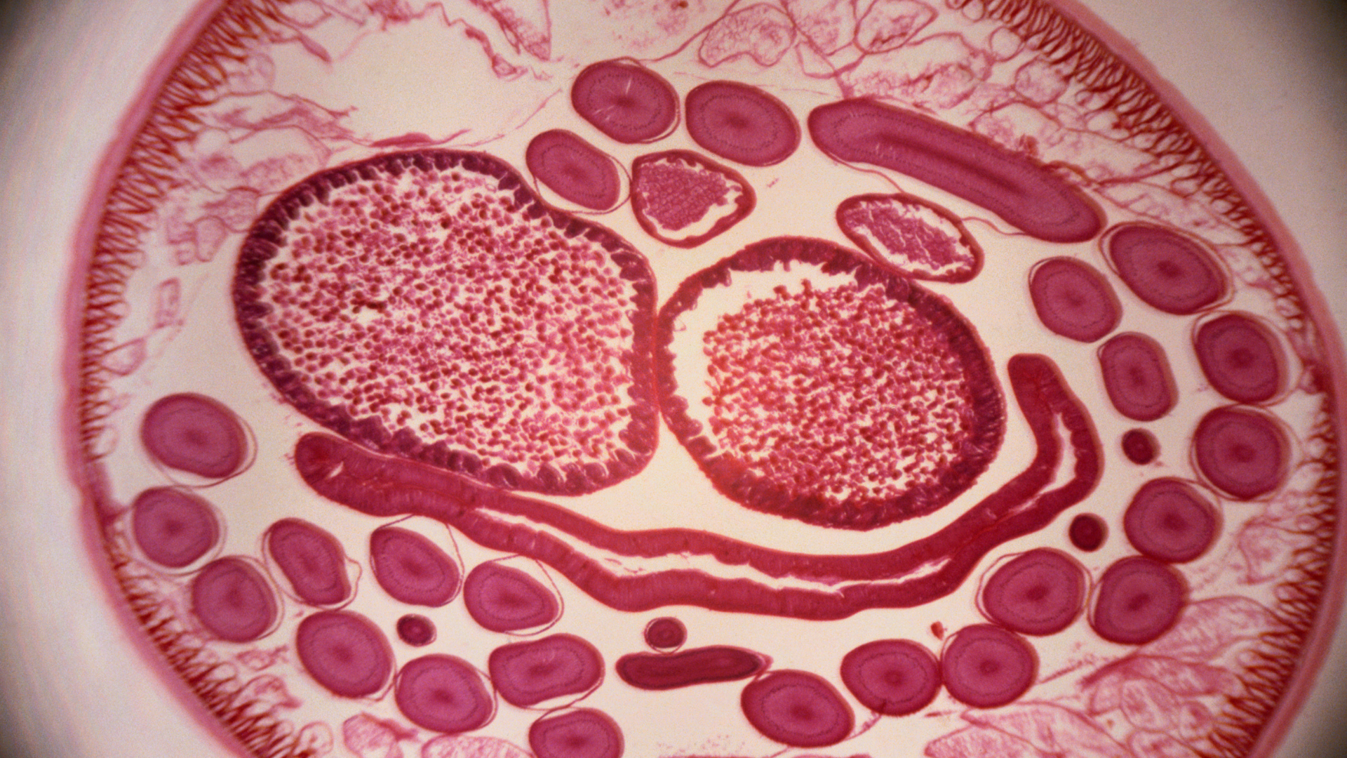 Khi&nbsp;giun tròn đã ở trong cơ thể, chúng sẽ tiêu thụ một phần chất dinh dưỡng mà chúng ta nạp vào mỗi ngày