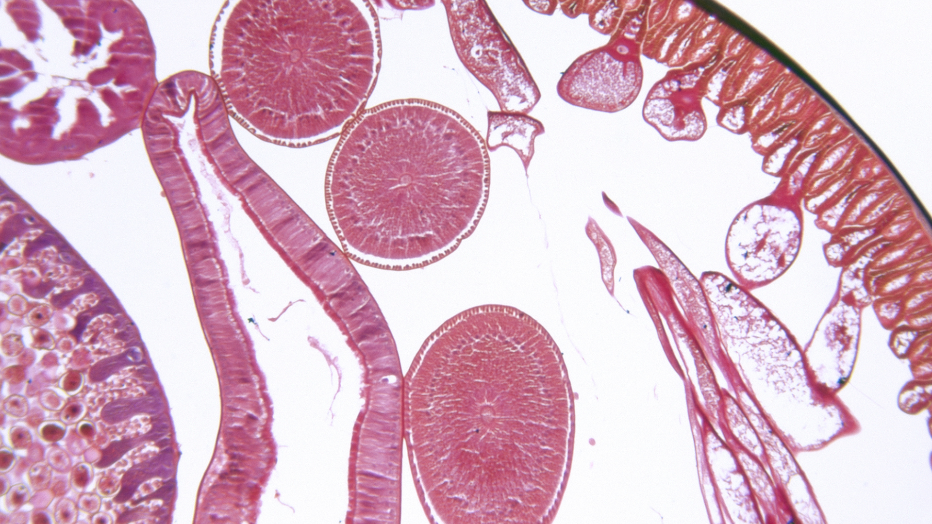 Cách ngăn ngừa&nbsp;giun tròn là duy trì những thói quen sinh hoạt tích cực mỗi ngày