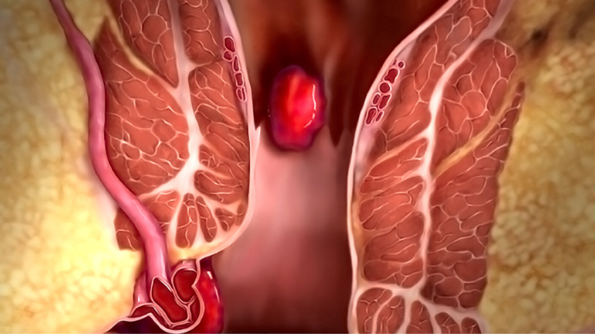 dau-hieu-nhiem-hpv-o-nam-gioi-nguyen-nhan-cach-dieu-tri-va-bien-phap-phong-ngua (3).png