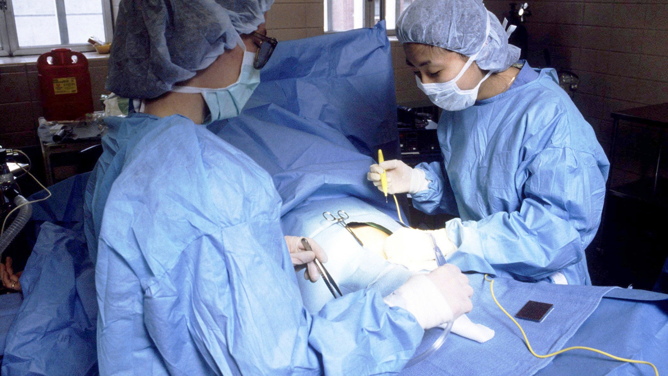 Nếu quy trình mổ không được thực hiện trong môi trường vô khuẩn nghiêm ngặt, vi khuẩn có thể xâm nhập gây nhiễm trùng
