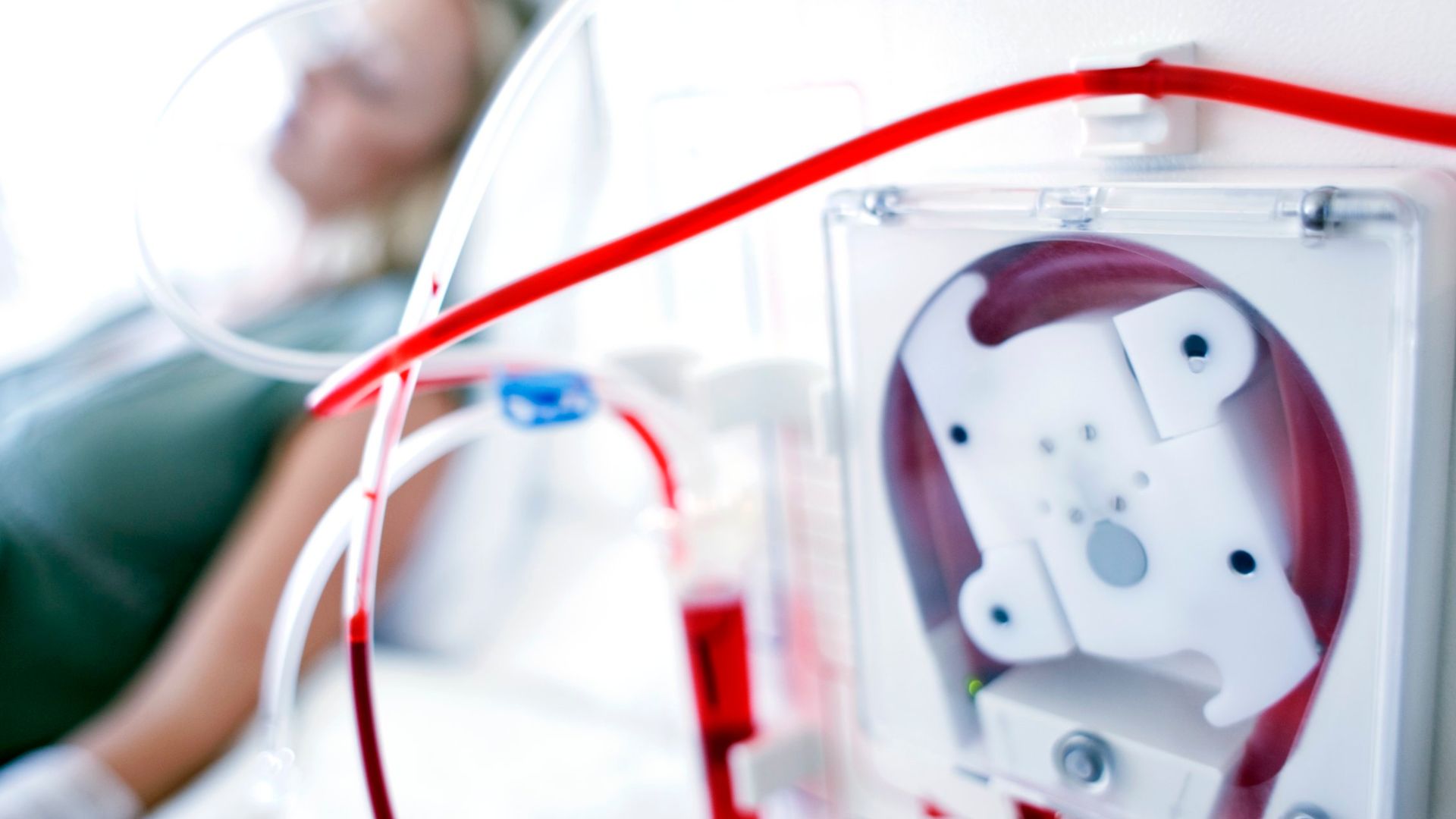 Chạy thận nhân tạo là một phương pháp điều trị trong suy thận giai đoạn cuối