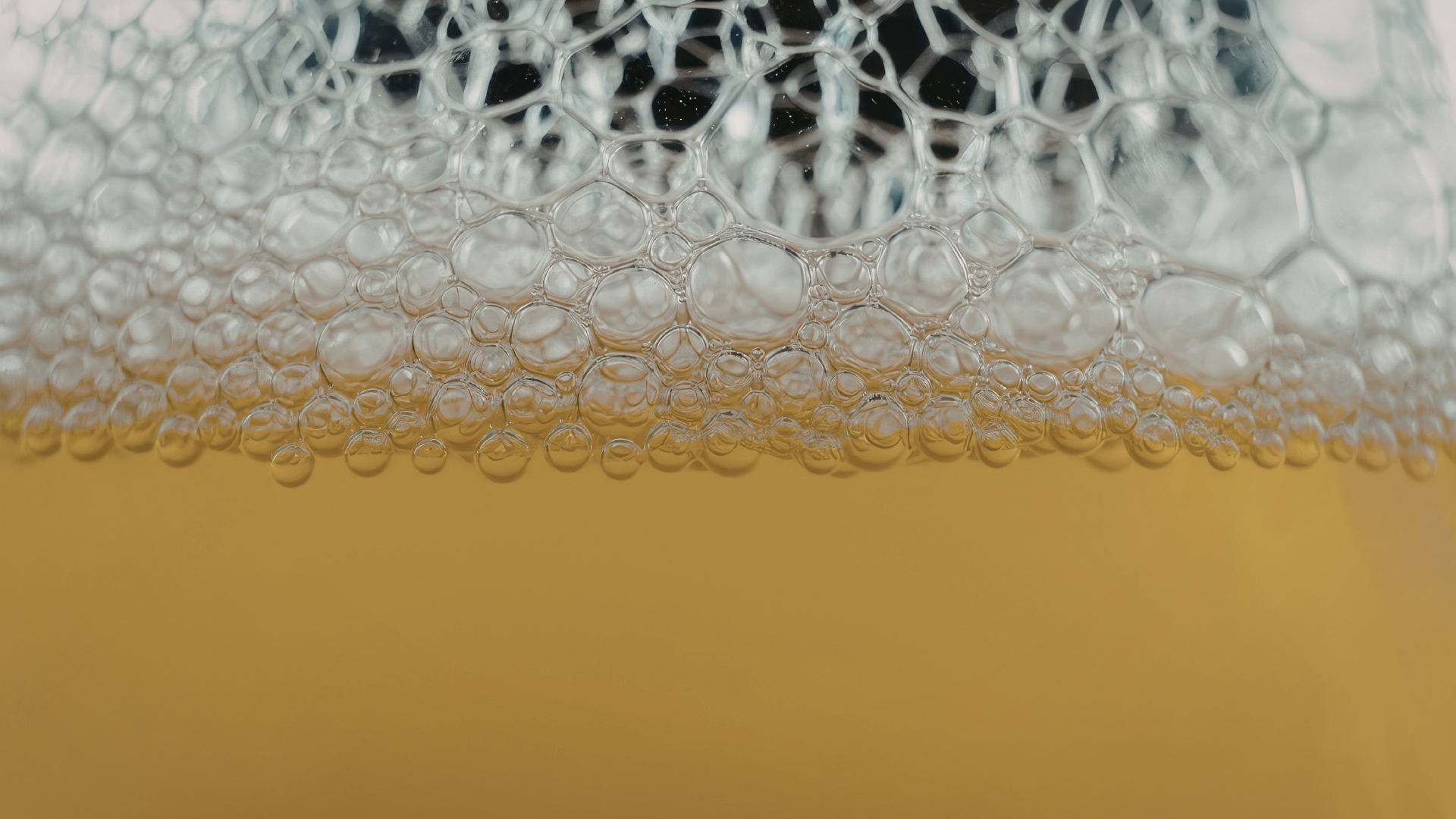 Dấu hiệu suy thận nặng dễ bị bỏ qua cần được nhận biết sớm