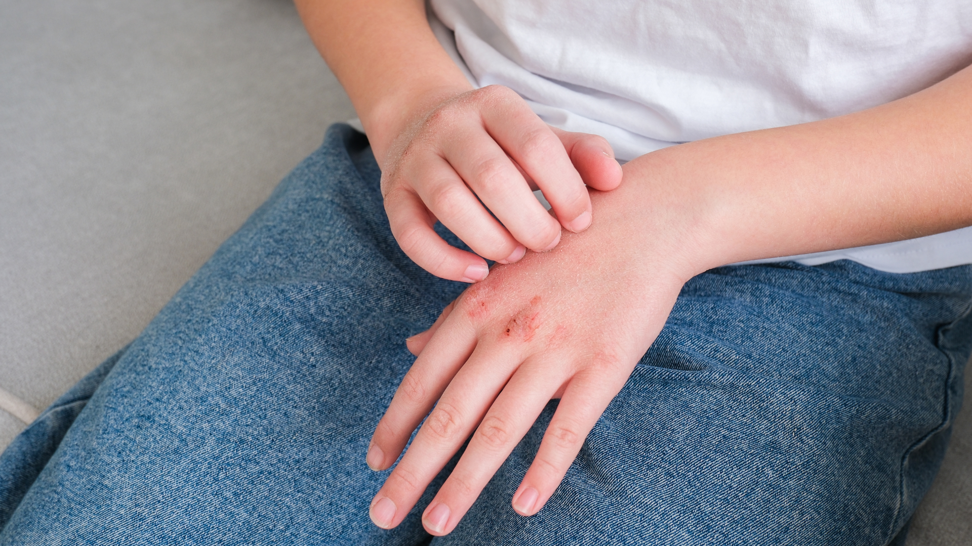 Khi chức năng thận suy giảm, các chất thải không được đào thải hết có thể ảnh hưởng đến làn da gây ngứa