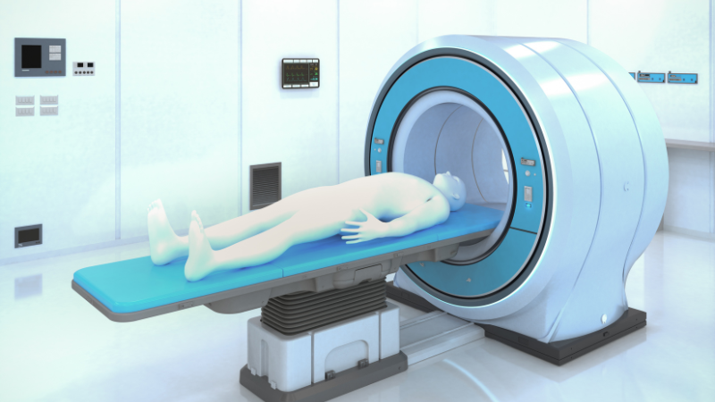 Dấu hiệu ung thư não giai đoạn đầu: Cách nhận biết và phòng ngừa 3