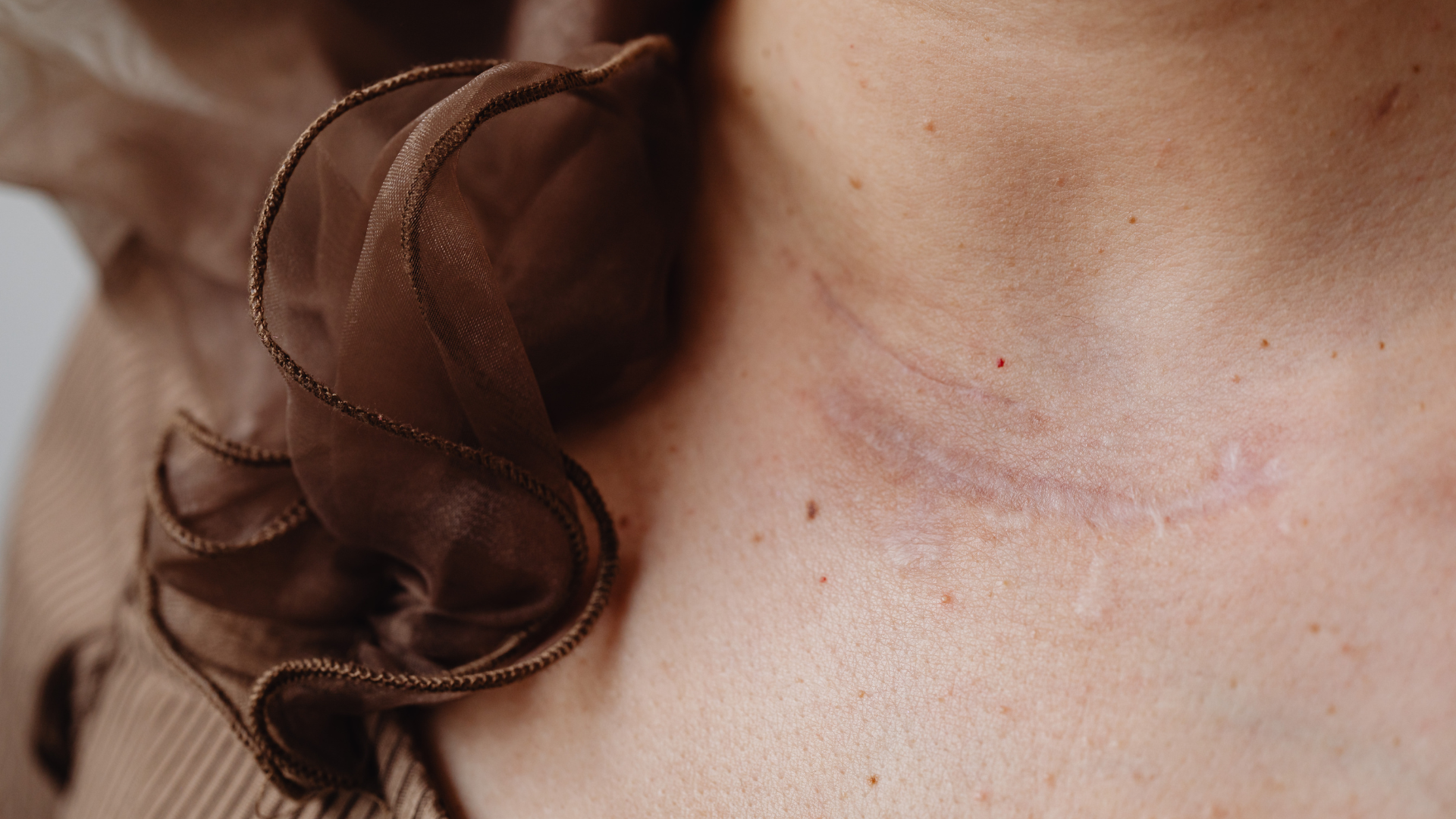 dau-hieu-vet-thuong-dang-lanh 2.png