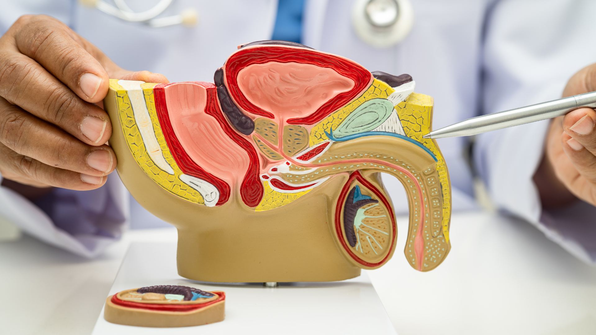 Ai dễ gặp phải tình trạng vô sinh nam?