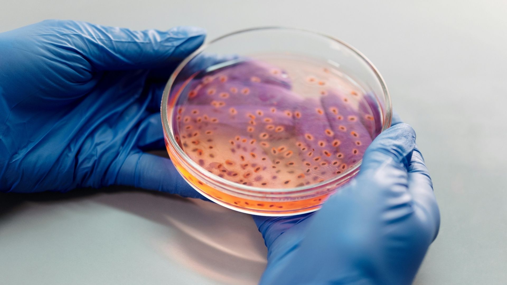 Chứng đau khi xuất tinh có thể gây ra do nhiễm trùng đường tiểu