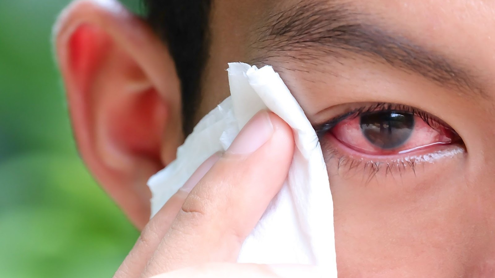 Sau khi dùng khăn giấy để lau dịch tiết từ mắt thì nên rửa tay ngay lập tức