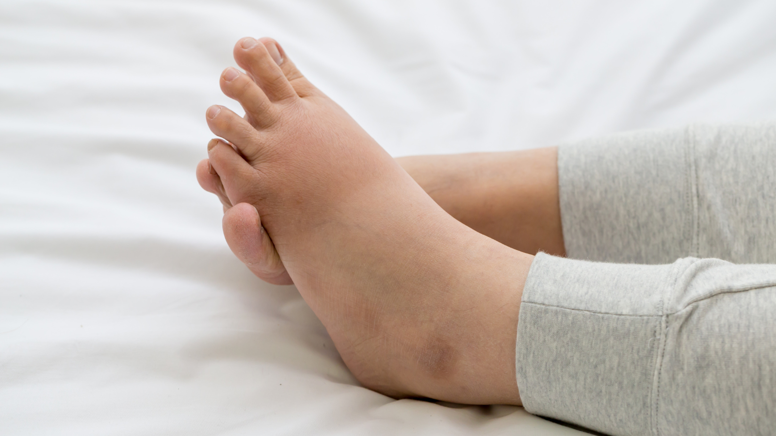 Đau thận ở vị trí nào? Dấu hiệu nhận biết và cách phòng bệnh 2