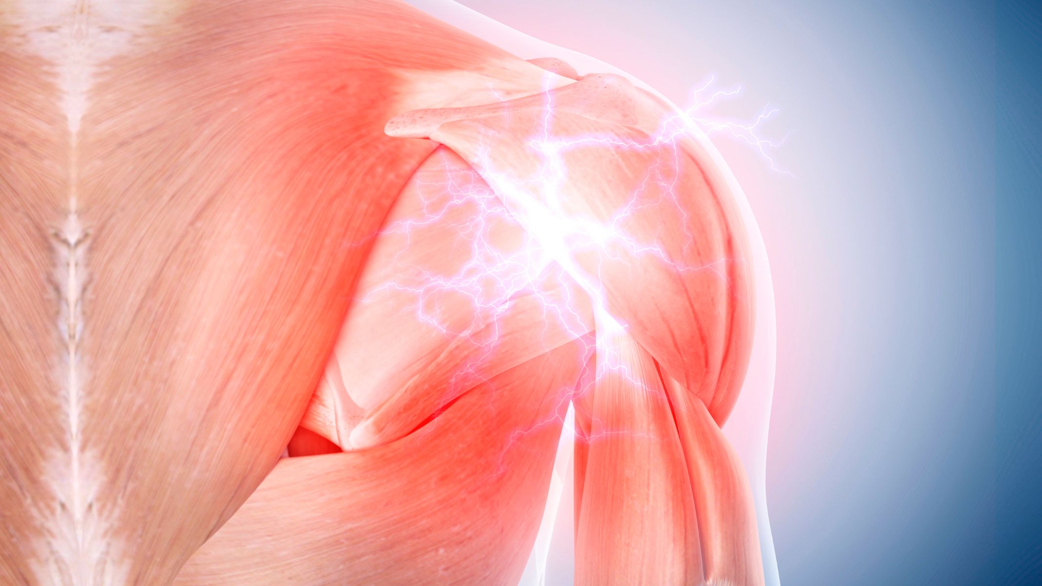 Bao khớp vai gồm ba dây chằng chính là dây chằng vai trên, vai giữa và vai dưới