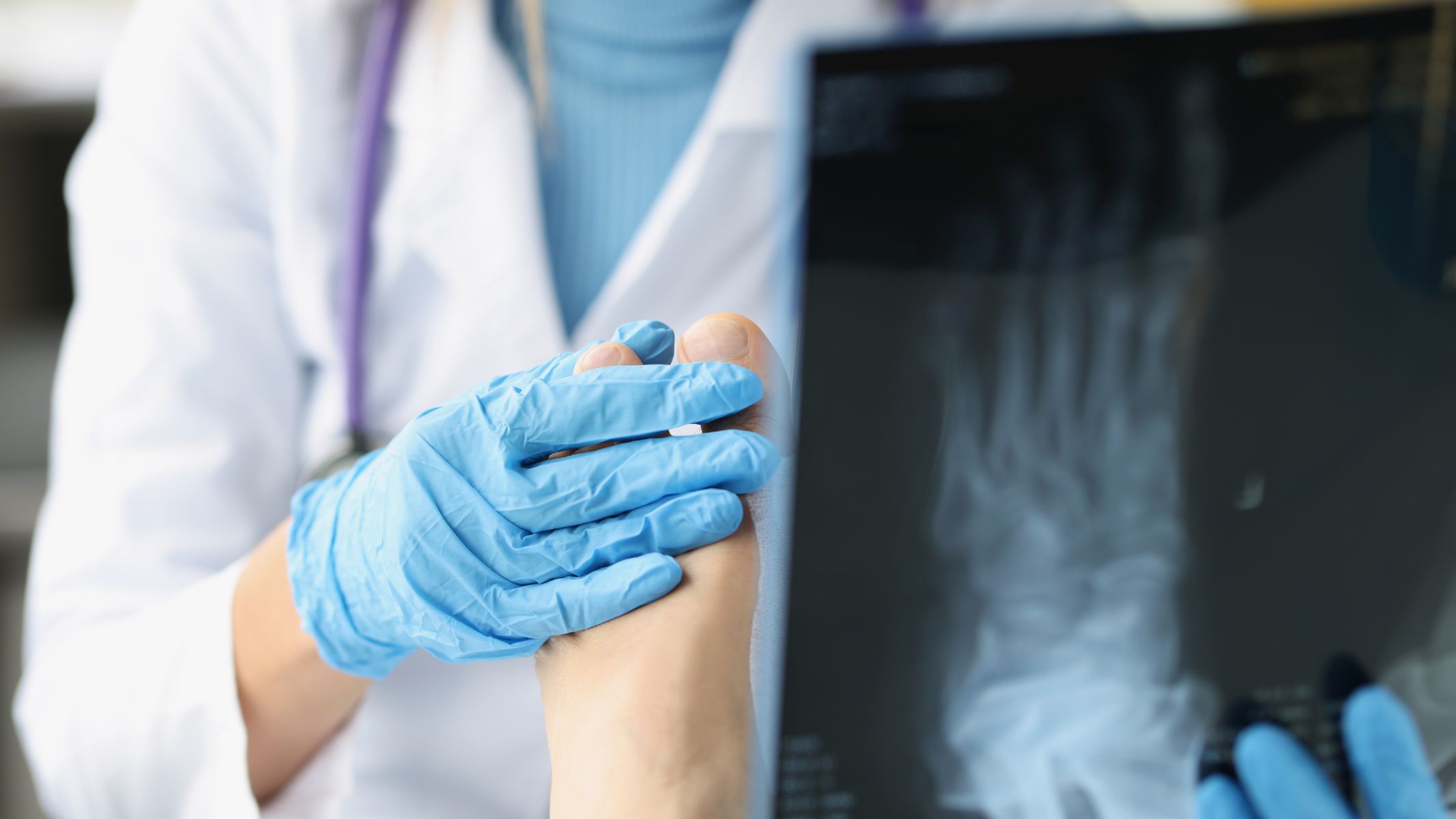 Tùy loại vật liệu và cơ sở điều trị, chi phí có thể cao hơn so với dùng gân tự thân