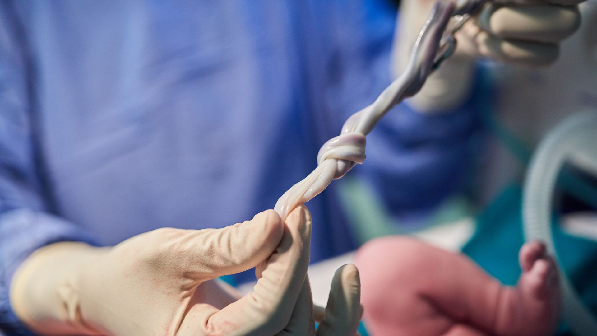 Dây rốn quấn cổ 1 vòng sinh thường được không