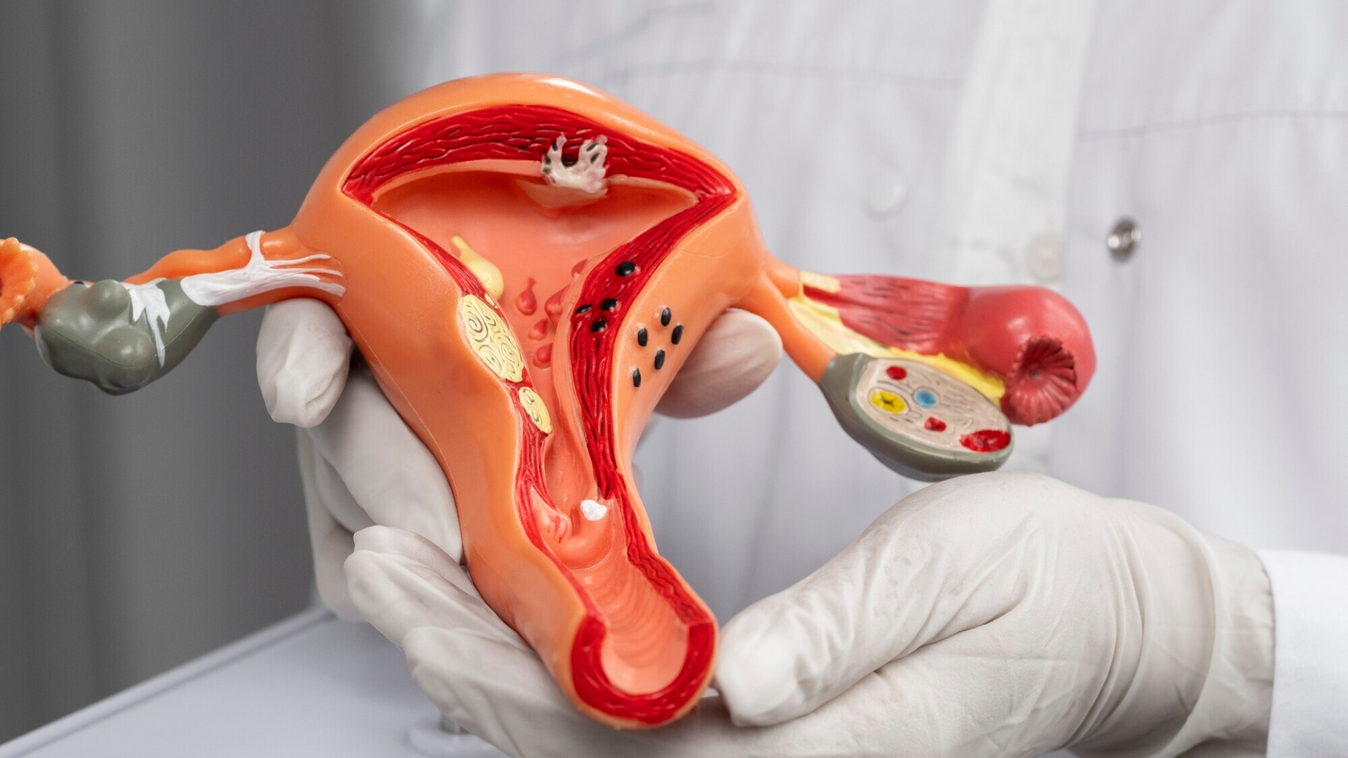 day-thanh-bang-quang-nguyen-nhan-dau-hieu-va-huong-xu-ly-hieu-qua 1.png