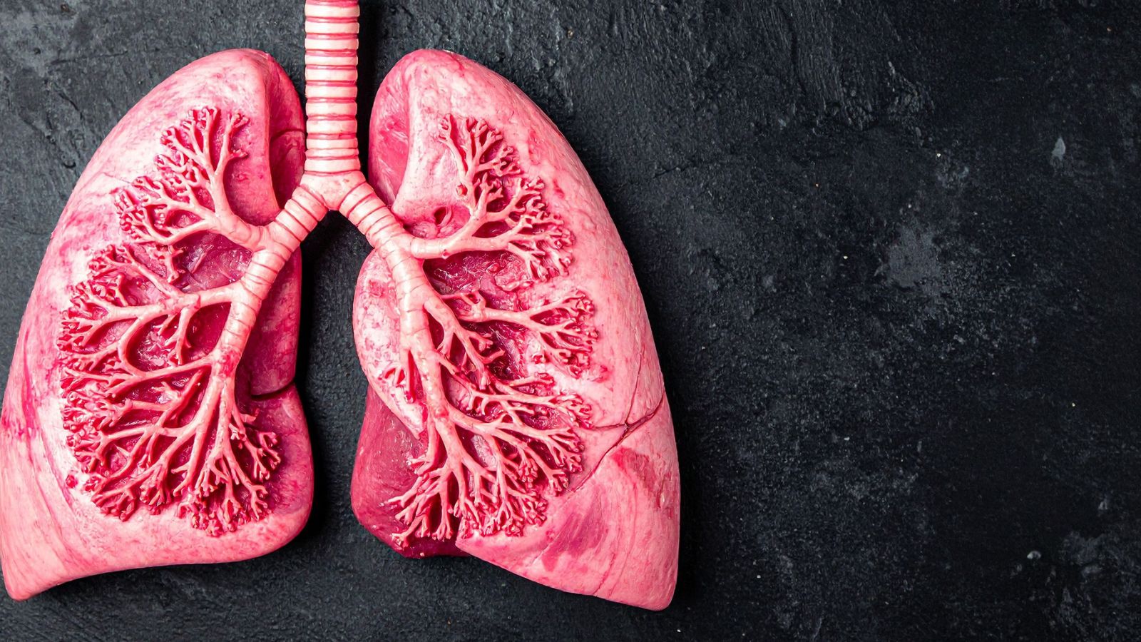 Dày thành phế quản là thuật ngữ thường được nhắc đến trong kết quả chụp X-quang hoặc CT phổi