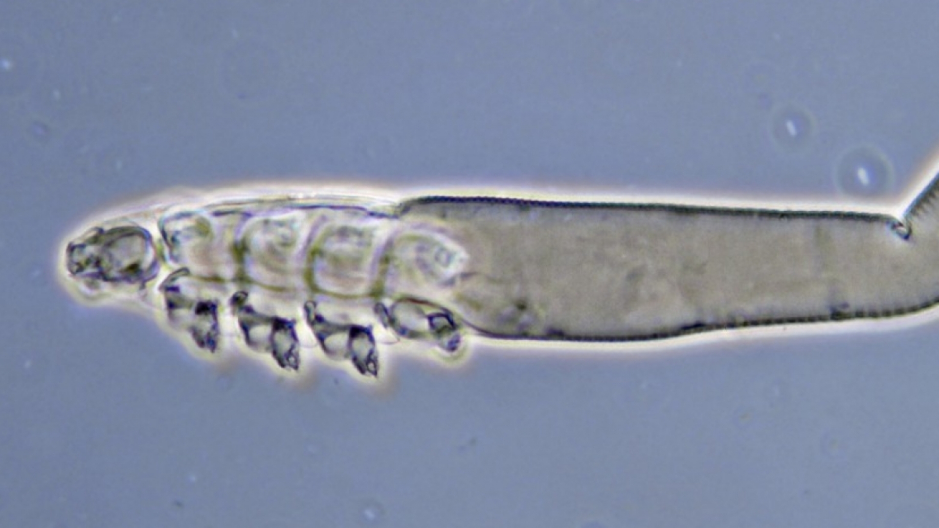 Demodex là một loại ký sinh trùng hình ống, sống ký sinh chủ yếu tại các nang lông và tuyến bã của người