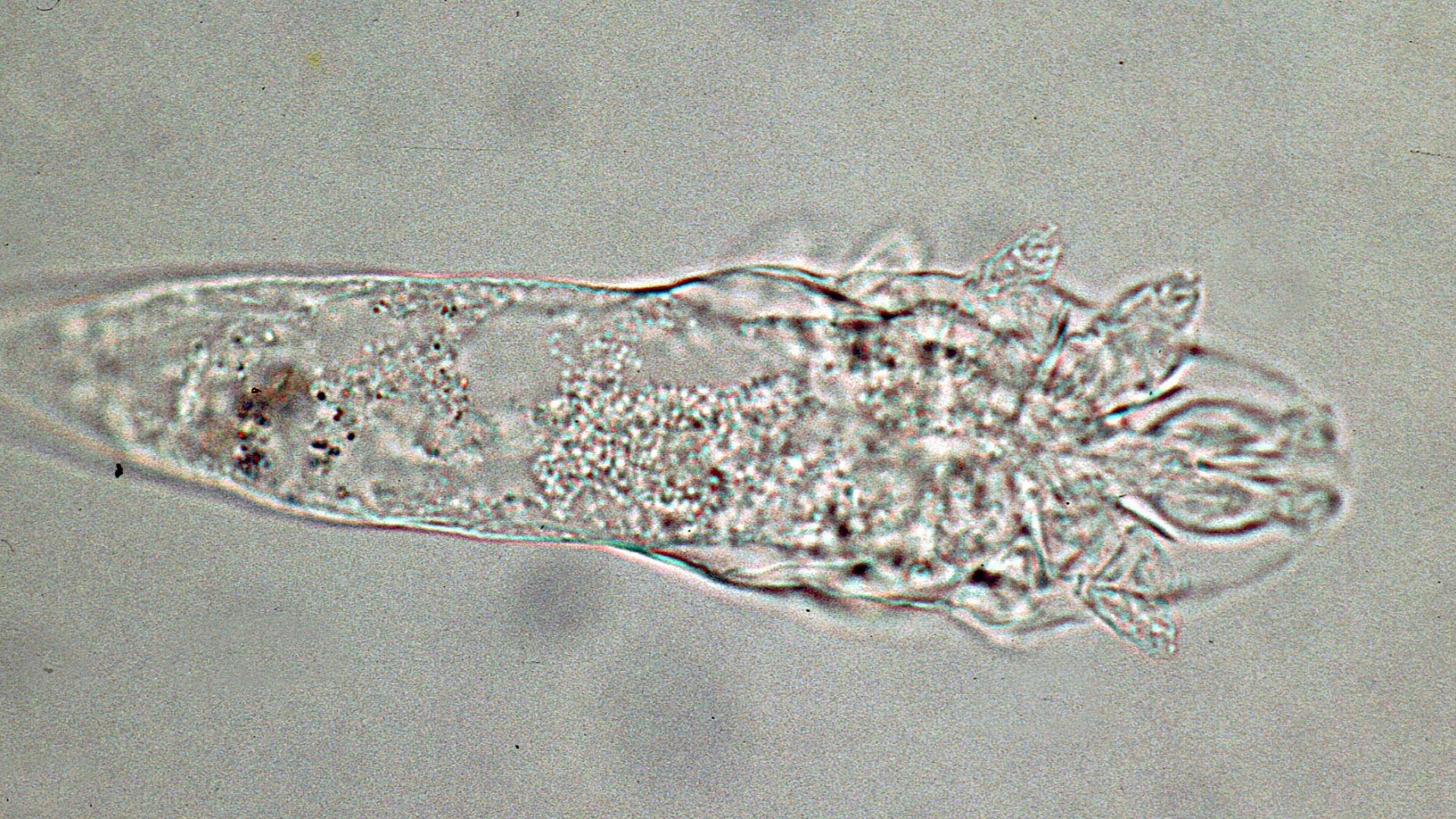 Giá trị chẩn đoán của phương pháp soi tươi nằm ở khả năng phát hiện ký sinh trùng còn sống