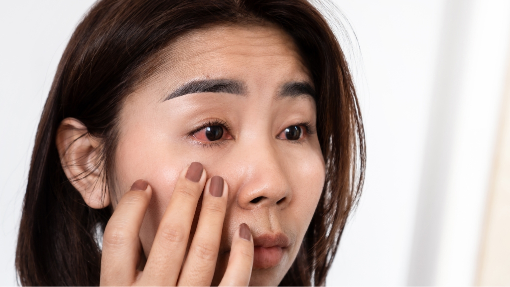 Đeo lens ngủ trưa được không? Tác hại và cách sử dụng lens an toàn 3