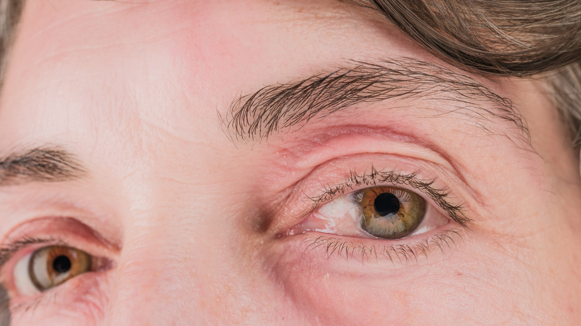 Võng mạc là nơi DHA hiện diện với mật độ rất cao