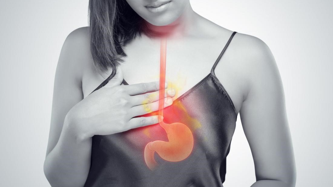 Ợ nóng ợ chua là một trong những triệu chứng của bệnh dị sản ruột dạ dày