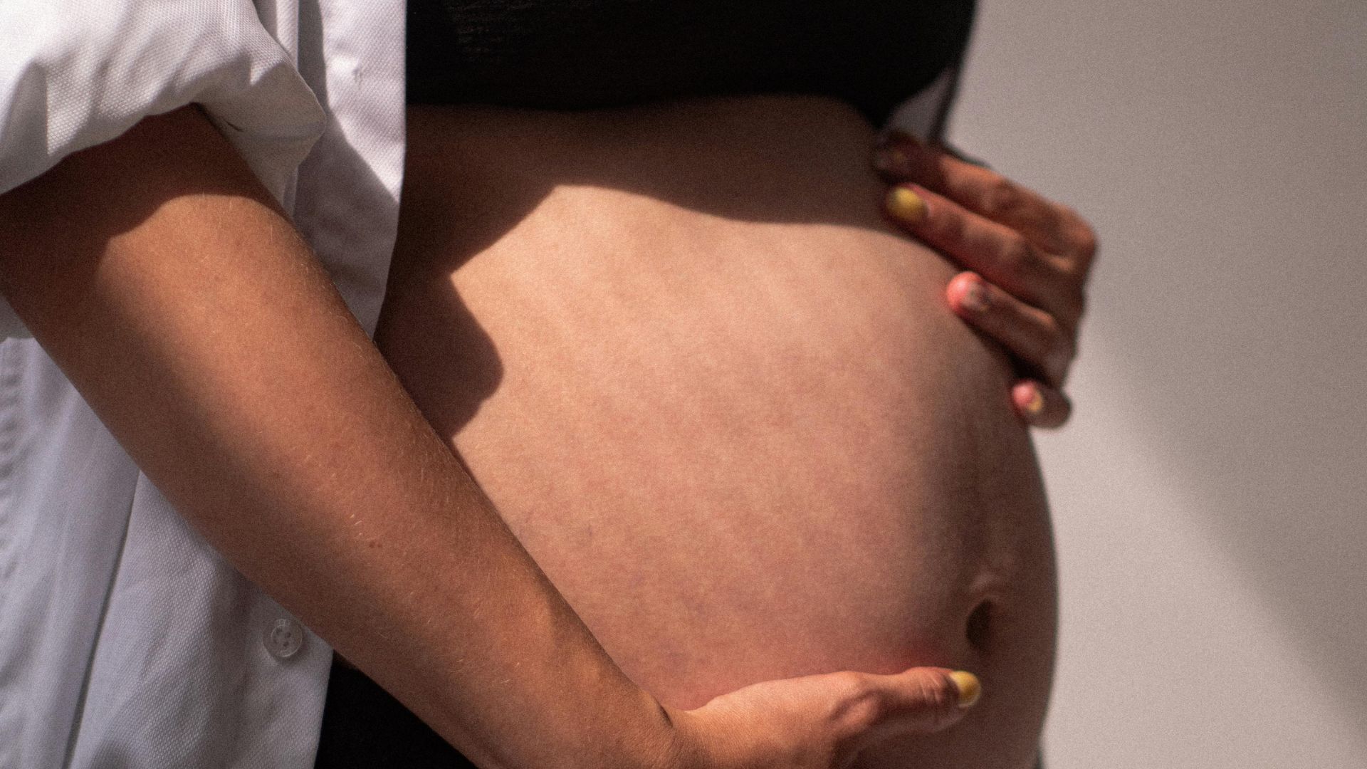 Dị tật ống thần kinh thường do sự kết hợp của các yếu tố di truyền, dinh dưỡng và môi trường